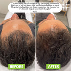 REVURA™ Hair Revive Roll-On