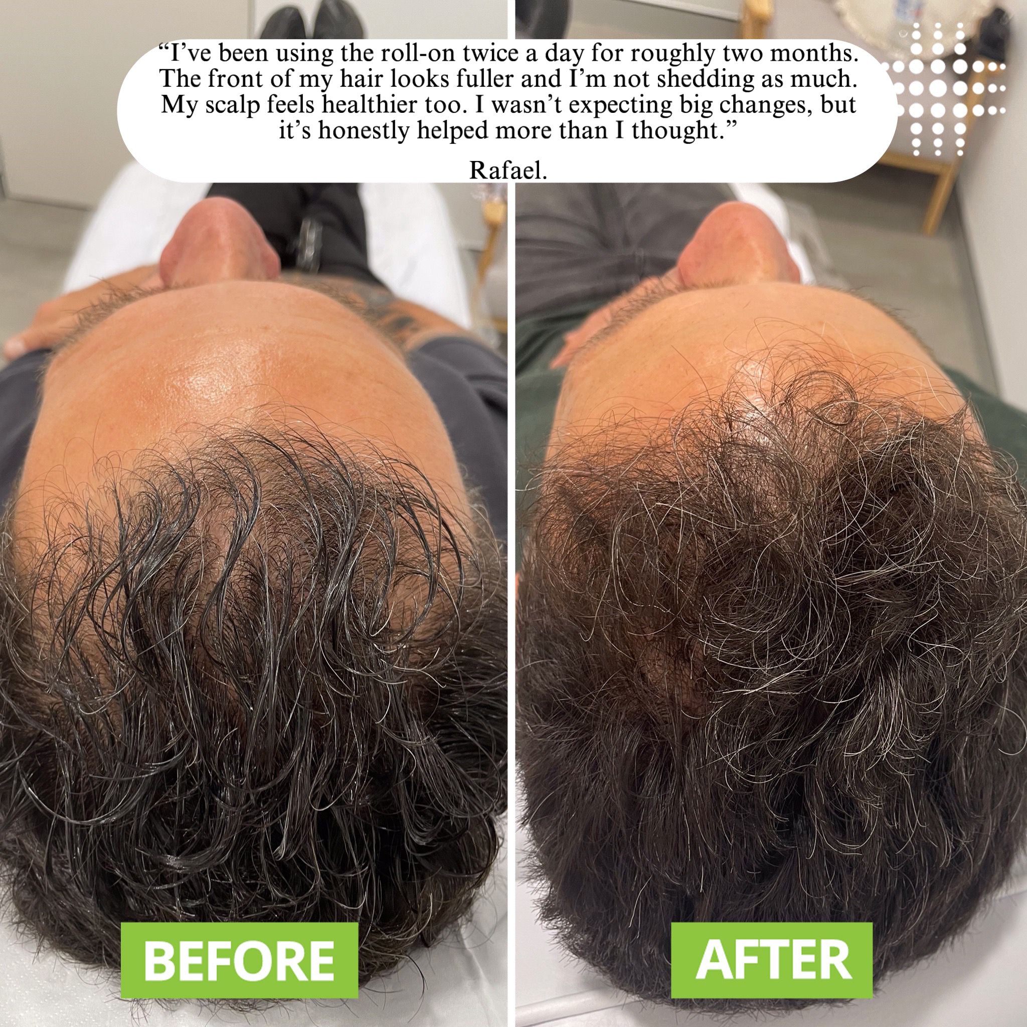 REVURA™ Hair Revive Roll-On