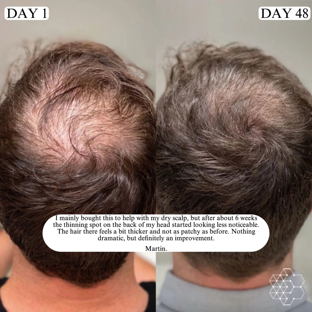 REVURA™ Hair Revive Roll-On