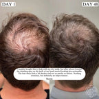 REVURA™ Hair Revive Roll-On