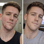 Revura™ GHK-Cu Peptide Serum